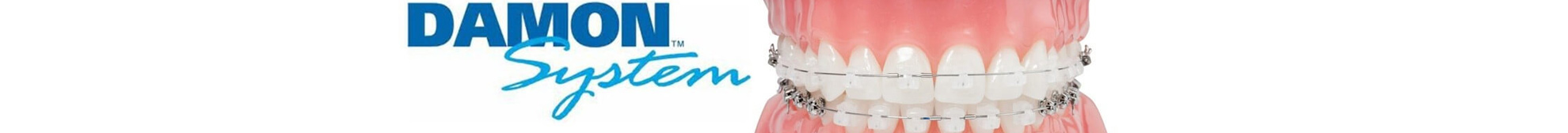 Ортодонтия - Клиника эстетической стоматологии 